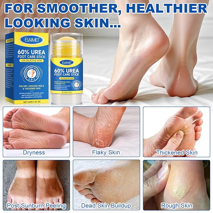 60% Urea with 2% Salicylic Acid Urea Foot Care Stick, Heel Stick for Cracked Feet, Foot Care Cream Moisturizer for Dry Cracked Feet, Knees, Elbows, Hands -1.41oz