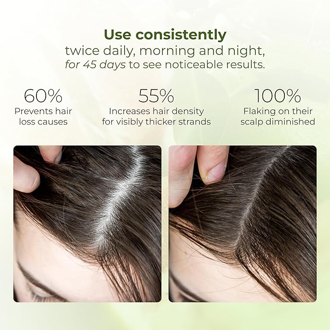 Cocoon Original Vietnam Pomelo Hair Tonic 140ml / 4.73 fl oz – Lightweight Scalp Serum for Thinning Hair, Hydrating, Strengthening & Anti-Breakage with Vitamin B5 & Baicapil
