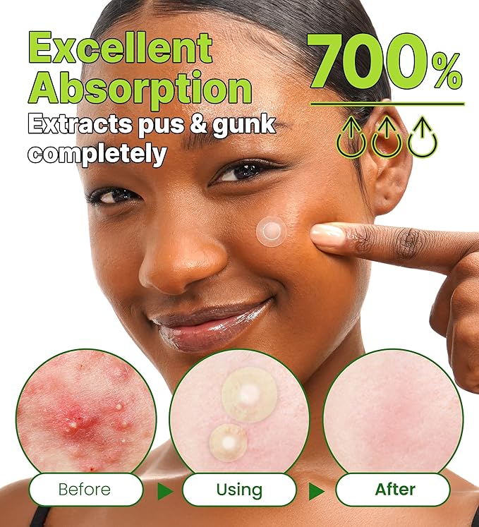 Troubless Invisible Plus Spot Patch with Thin Hydrocolloid Patches 96EA