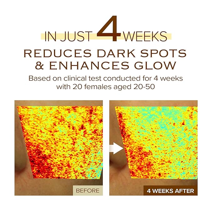 mimmua! NIACINDY Dark Spot Ampoule | NAD+, Niacinamide | Dark Spot Remover