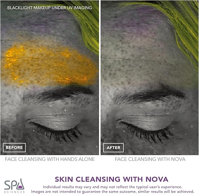 Spa Sciences NOVA - Sonic Cleansing Face Brush & Infusion System - Pink