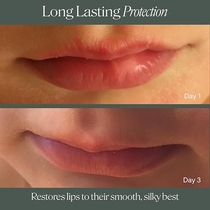 Doctor Rogers Lip Balm, Ultra Hydrating Lip Treatment, Clean Fragrance-free Lip Moisturizer for Soft Lips, Hypoallergenic, 0.15oz (4.25g)