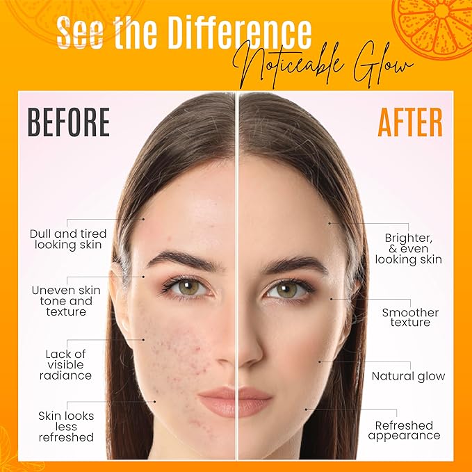 DERMAXGEN 30% Organic Vitamin C Serum for Face – Natural Anti-Wrinkle Serum with Hyaluronic Acid & Vitamin E – Anti-Aging Moisturizer for Fine Lines, Dark Spots & Skin Rejuvenation – 2 Fl oz