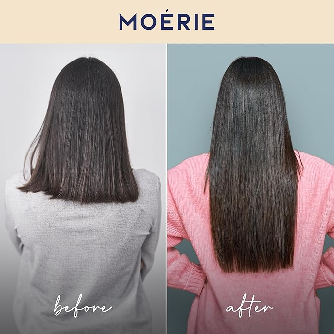 Moérie Hair Growth Shampoo, Conditioner, Spray and Mask for Men and Women, Hair Loss Solution with Biotin and Rosemary, Thickening Hair Regrowth Set with Serum Level Care for Thinning Hair, 4 Set