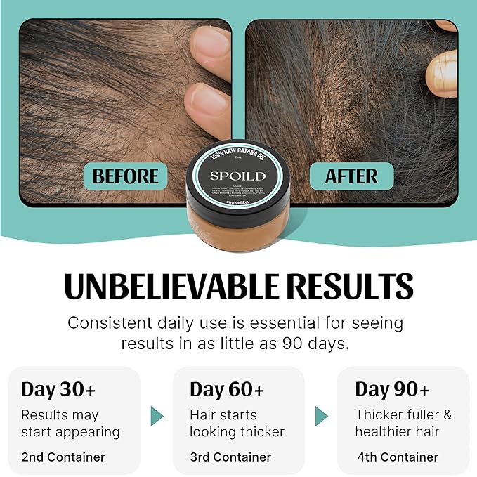 SPOILD Raw Batana Oil for Hair Growth - 100% Organic & Unrefined, Sourced from Honduras - Hair Thickening & Strengthening Oil - Reduces Hair Loss, Adds Shine & Repairs Damaged Hair, 2 oz