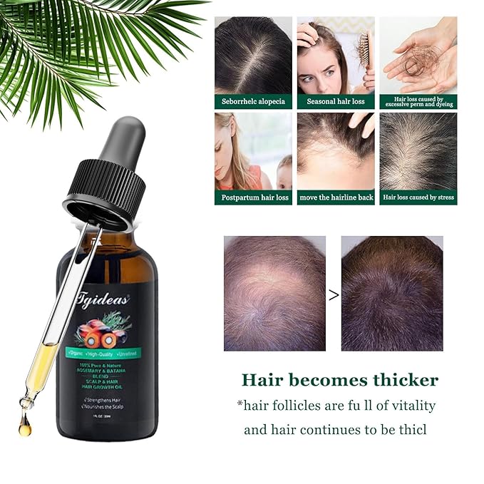 Tgideas Rosemary Batana Hair Oil for Scalp Care & Hair Strengthening 1 Pack