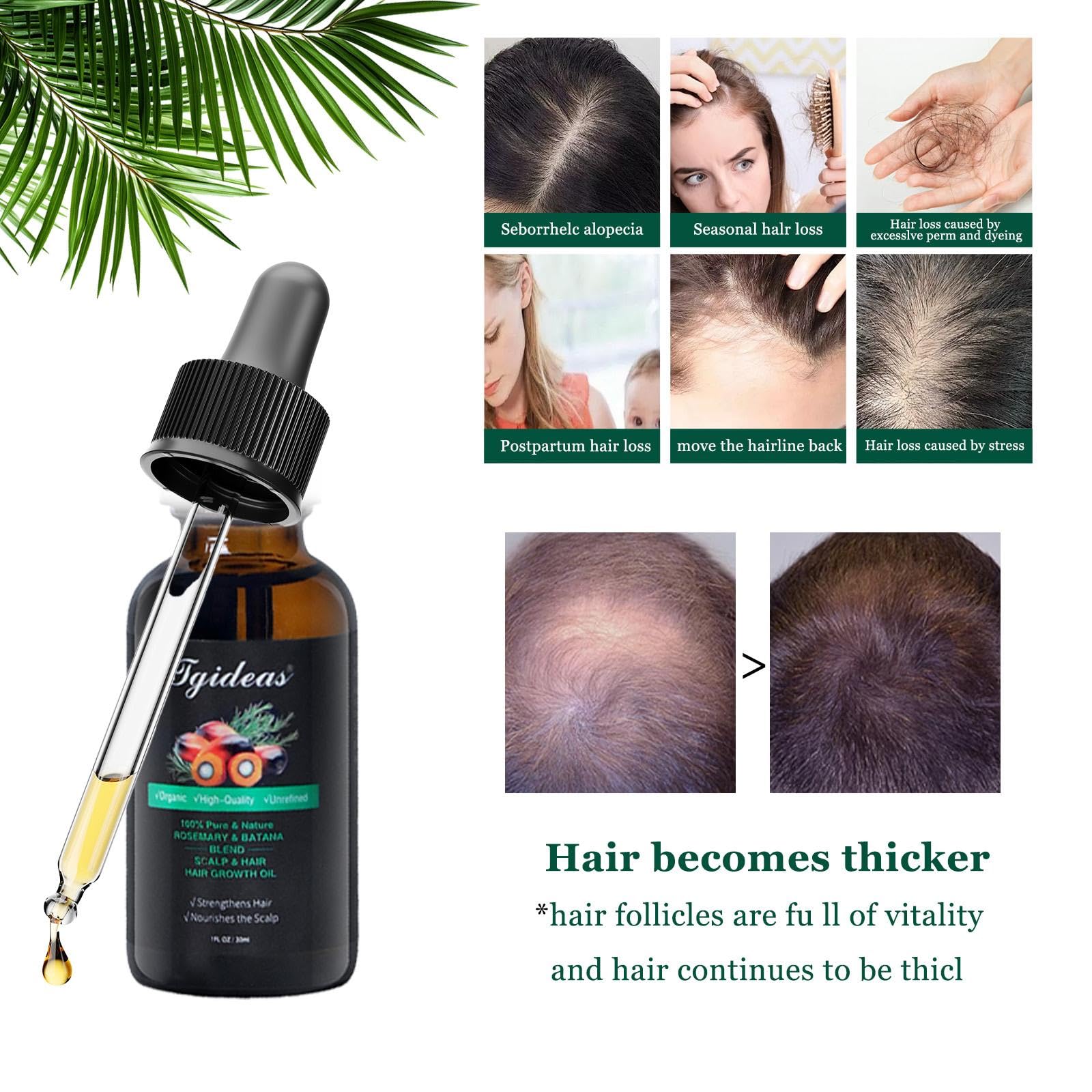 Tgideas Rosemary Batana Hair Oil for Scalp Care & Hair Strengthening 1 Pack
