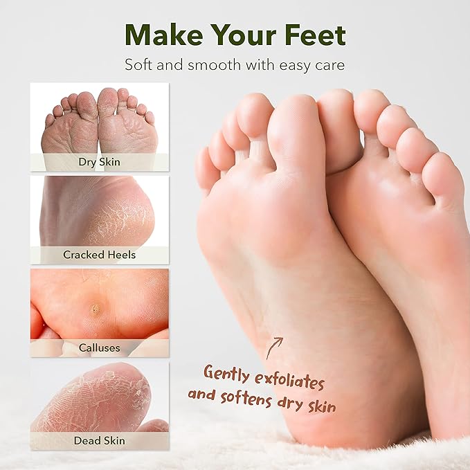 Purederm Foot Peeling Mask for Dry Cracked Feet, Exfoliating Treatment for Dead Skin & Calluses for Baby Soft Feet, 6 Pairs