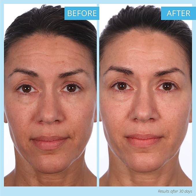 SKINN Crème Reverse Intensive Anti-Aging Cream