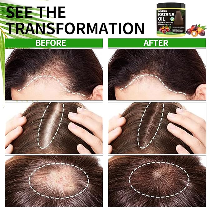 Raw Batana Oil for Hair Growth, 100% Natural Pure Batana Organic for Prevent Hair Loss, Enhances Thickness for Men & Women, Wild Growth Hair Oil, Scalp Treatment Promotes Hair Thickness 120ML