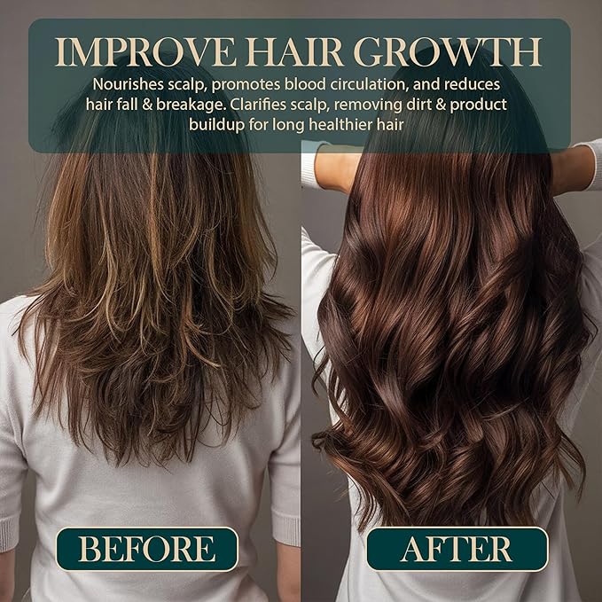 Pre‑Wash Scalp Oil for Dry, Itchy Scalp & Hair Growth | Rosemary, Biotin, Castor Oil | Hydrates, Reduces Flakes & Strengthens Roots | Fragrance‑Free, Lightweight Formula – 2 fl oz