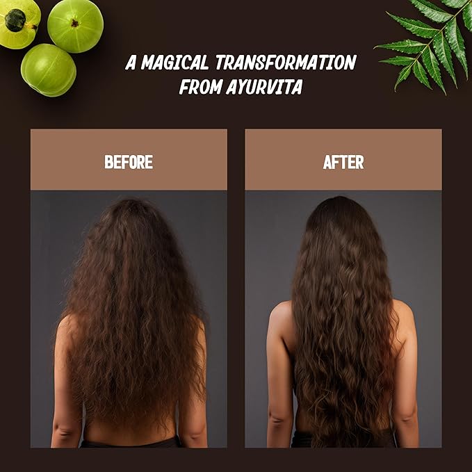 AyurVita Restorative Hair Oil - Amla for Strengthening & Neem for Preventing Dryness and Dandruff - For Dry, Damaged Hair Growth - For Men & Women - 2 fl oz