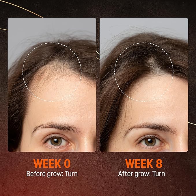 Abera Hair Growth Serum for Hair Loss, Natural Hair Regrowth Treatment for Hair & Beard with Biotin & Maca | Extra Strength & Bigger Size 1.69 fl oz (1 Serum + Gift)