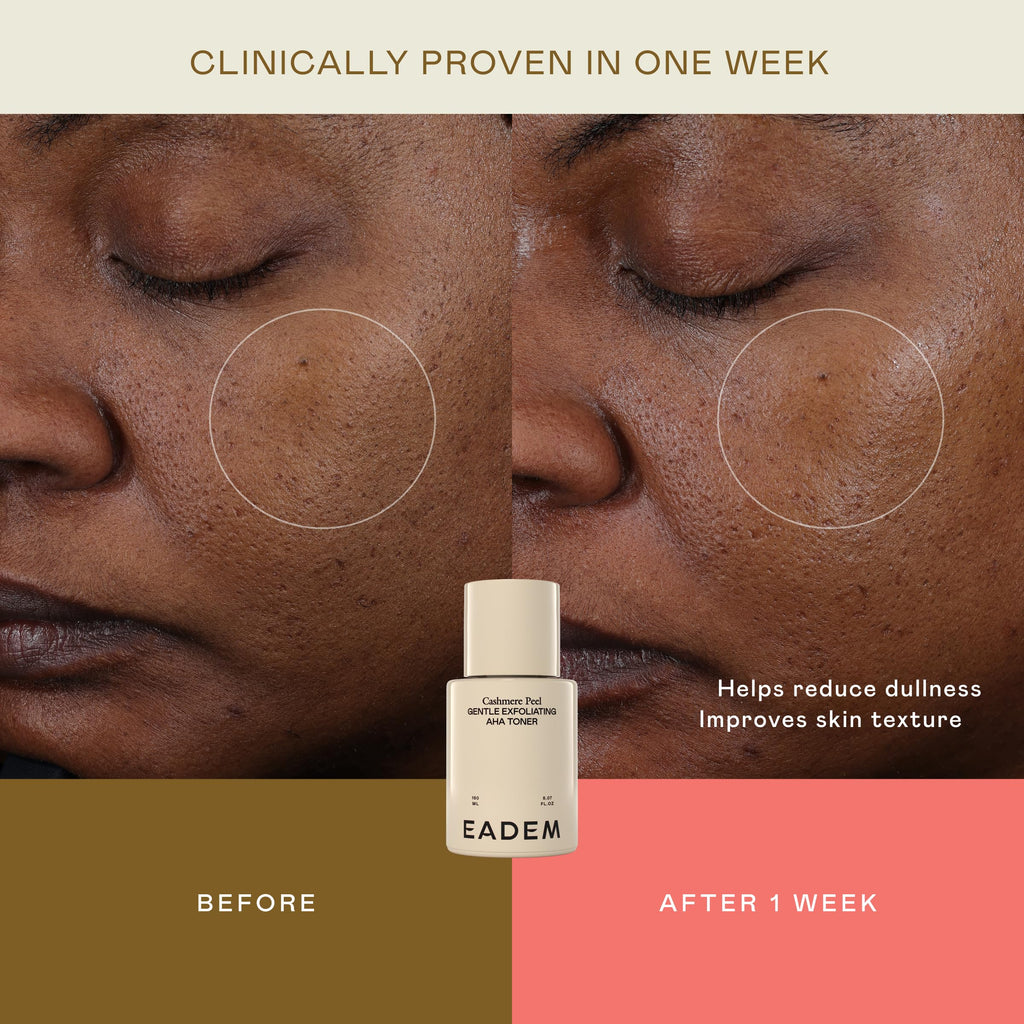 EADEM Milky Rice Exfoliating Toner, AHA & PHA Face Exfoliant Pore Minimizer