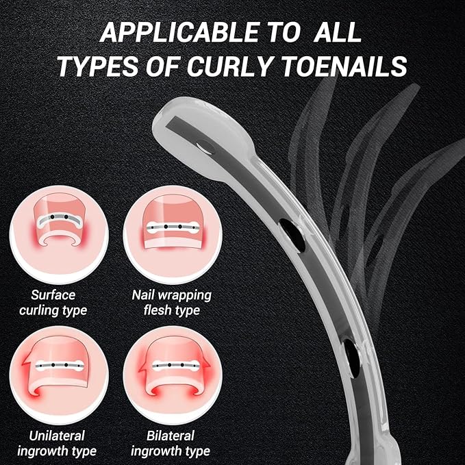 Reieset Titanium Alloy Ingrown Toenail Treatment, Nail Tools, and Ingrown Toenail Removal Kit Specially Designed for Curved Nail Repair and Ingrown Toenail Corrector (0.59/0.67in)
