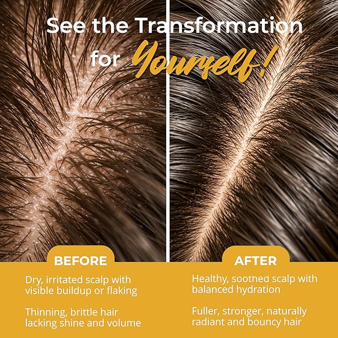 Argan Oil Shampoo & Conditioner Set for Women, Postpartum & Menopause Hair and Scalp Treatment with Argan Oil, Sulfate Free, Leave In Conditioner & Hair Oil for Thinning-Looking Hair