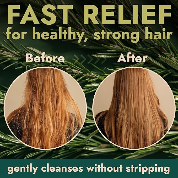 Rosemary Shampoo and Conditioner Set with Tea Tree for Hair Growth & Scalp