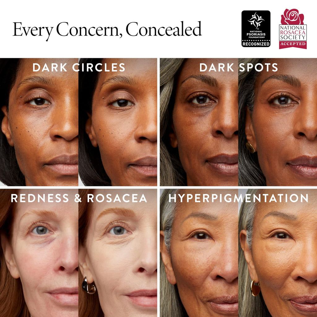 LAURA GELLER NEW YORK Ideal Fix Under Eye Concealer for Mature Skin – 04 Medium - Full Coverage, Anti-Aging, Color Correcting – Covers Dark Circles & Blemishes – Hydrating, Crease-Free, Long-Lasting