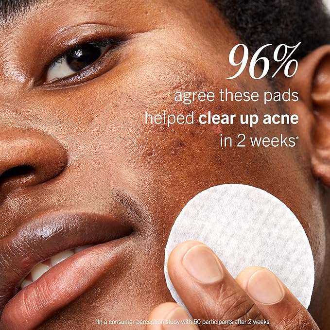 First Aid Beauty Acne Treatment Pads, 2% Salicylic Acid, 60 ct
