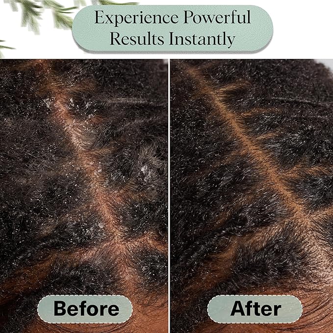 Kitsch Rosemary Oil for Hair Growth -With Castor Oil, Biotin & Jojoba- 10mL