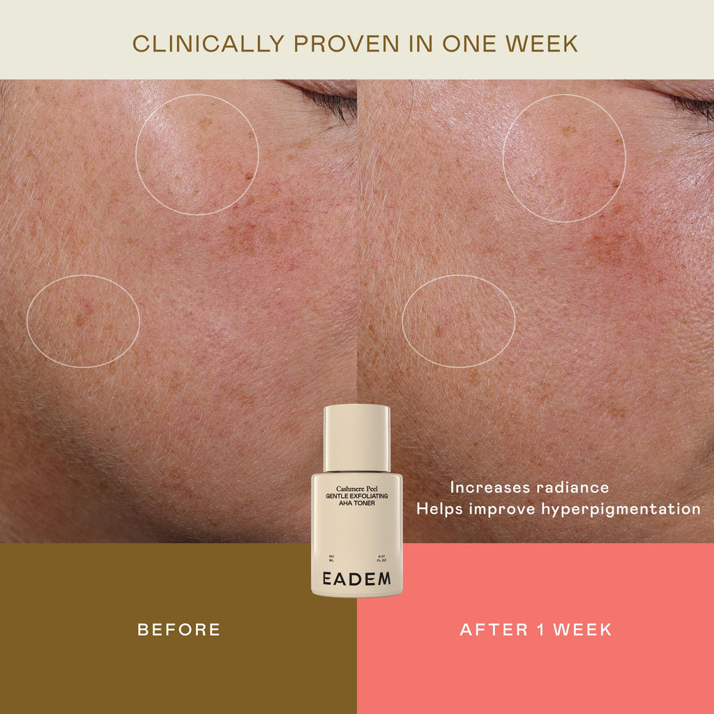 EADEM Milky Rice Exfoliating Toner, AHA & PHA Face Exfoliant Pore Minimizer