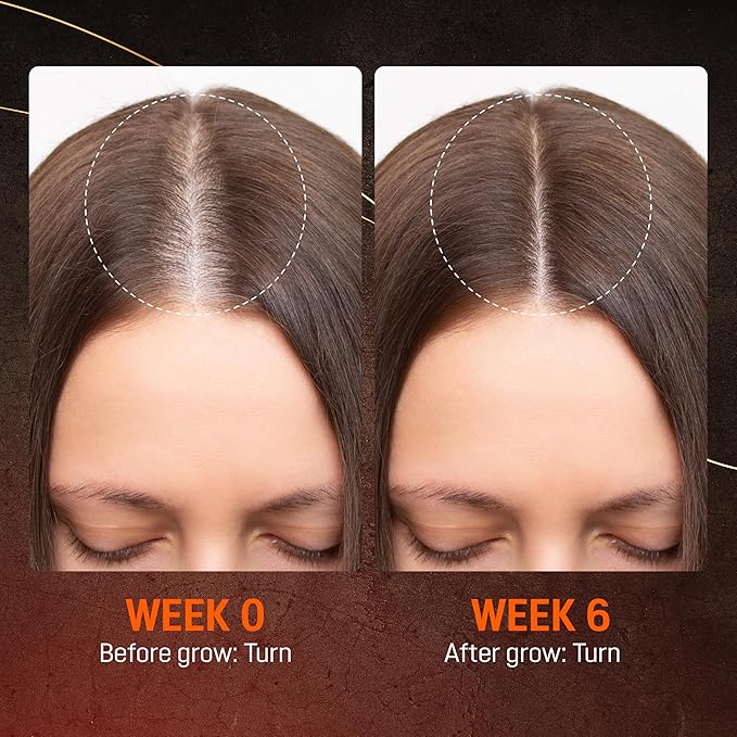 Abera Hair Growth Serum for Hair Loss, Natural Hair Regrowth Treatment for Hair & Beard with Biotin & Maca | Extra Strength & Bigger Size 1.69 fl oz (1 Serum + Gift)