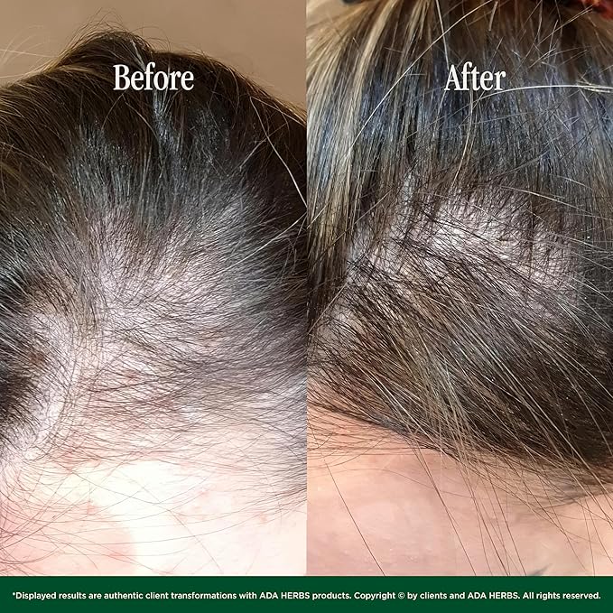 ADA HERBS Hair Oil Mask Pre-Wash & Overnight 100% Natural Hair Growth Oil with Cold Pressed Argan, Castor, Jojoba, Rosemary, Vitamin E (8.45 Fl Oz)