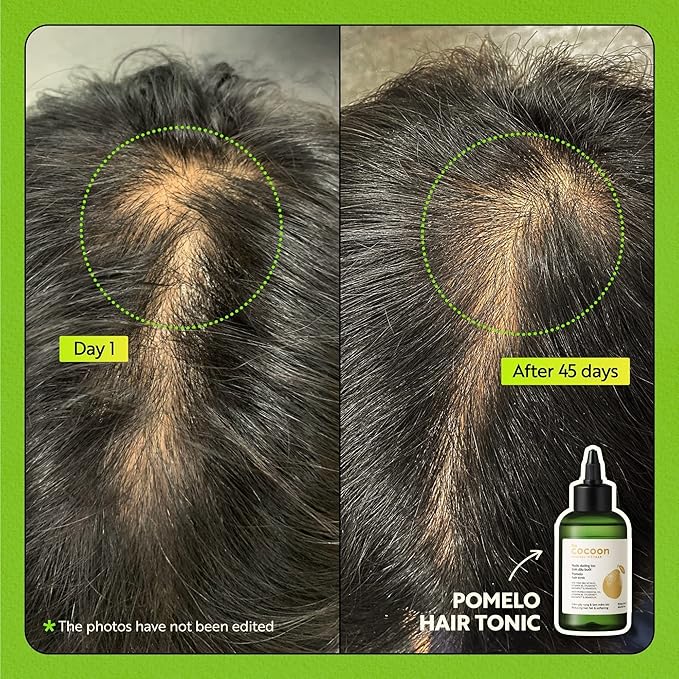 Cocoon Original Vietnam Pomelo Hair Tonic 140ml / 4.73 fl oz – Lightweight Scalp Serum for Thinning Hair, Hydrating, Strengthening & Anti-Breakage with Vitamin B5 & Baicapil